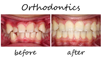 Orthodontics 1